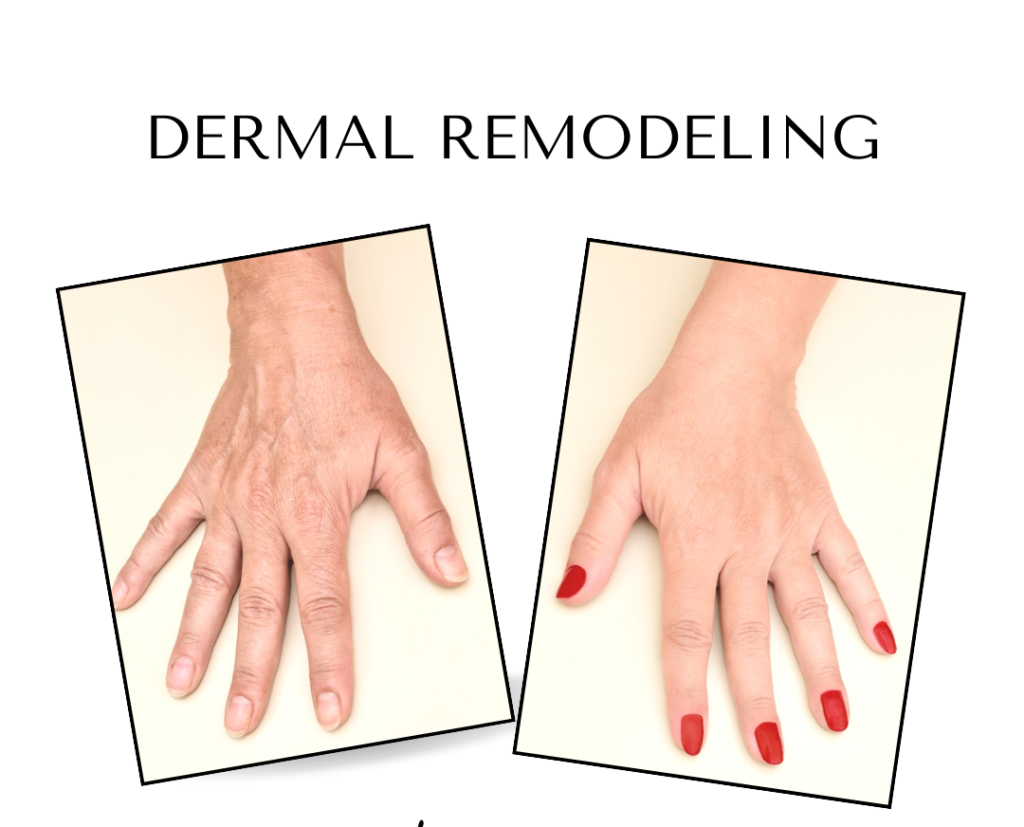 hands canva 2 - Brigitte Biller Cosmetic